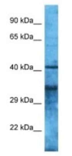 OR4S2 Rabbit anti-Human, Polyclonal, Novus Biologicals:Antibodies:Primary